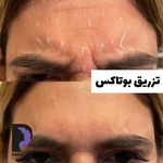 کلینیک زیبایی پوست و مو و لیزر پامچال