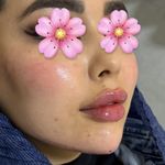 خانه لیزر فیلر و بوتاکس ثنا