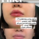 کلینیک پوست مو لیزر ونوس