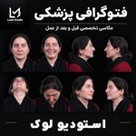 فتوگرافی پزشکی لوک