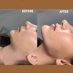 کلینیک پوست و زیبایی ژیلاوَش