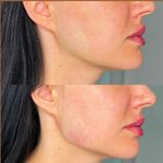 کلینیک پوست و زیبایی ژیلاوَش