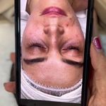 مرکز  فیشیال تخصصی رامو اسکین