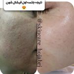 پاکسازی صورت فیشال تخصصی بانو