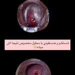 کارشناس مامایی فراهانی