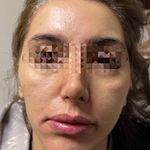 مجموعه  پوست و مو و  لیزرو زیبایی دنیز