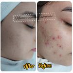 خدمات تخصصی پوست و مو نوشین اسماعیلی