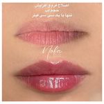 کلینیک زیبایی و لیزر مو زائد نوبا