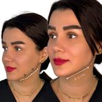 نیوا کلینیک تبریز