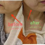 مرکز لیزرو کلینیک زیبایی طراوت