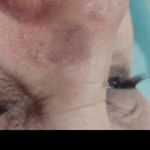 مرکز لیزرو کلینیک زیبایی طراوت