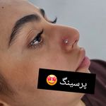 کلینیک هانیل | فیلر و بوتاکس شرق
