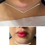 کلینیک زیبایی و لیزر لوتوس