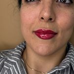 کلینیک پوست و زیبایی ولاغری تاج عظیمیه