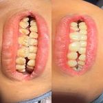 کلینک دندانپزشکی وایت(با شرایط اقساطی)