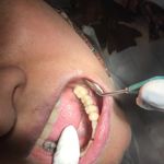کلینک دندانپزشکی وایت(با شرایط اقساطی)