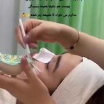 فیشیال و پاکسازی تخصصی پوست مرضیه