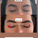 کلینیک زیبایی و لیزر دکتر آزاده اسماعیلی