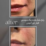 کلینیک پوست و مو و لیزر نیلوفر آبی