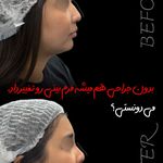 کلینیک زیبایی و جوانسازی پوست و مو الین