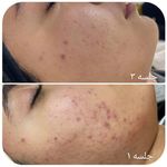 خدمات فیشال پاکسازی/اسکالپ اسکراپ ماهرخ