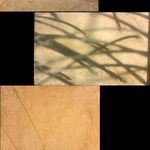 خدمات تخصصی فشیال پوست