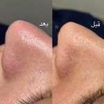 پاکسازی پوست و مو مهسام