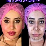 کلینیک زیبایی و مرکز لیزر و هایفو و آراف