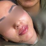 کلینیک زیبایی و مرکز لیزر و هایفو و آراف