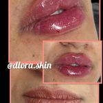 کلینیک زیبایی و مرکز لیزر و هایفو و آراف