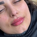 کلینیک زیبایی، پوست و لیزر(کندلا)  ظفر