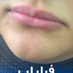 کلینیک زیبایی دکتر فاطمه کوچالی