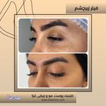 مطب پوست مو زیبایی فردوس شرق
