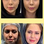 کلینیک ژل بوتاکس لیزر فیل بیوتی