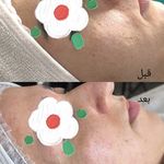 Derma Elan