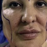 کلینیک زیبایی الماس کاملا اقساطی