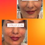 کلینیک لیزر و زیبایی مهسان