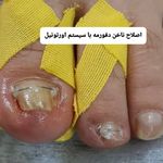 پدیکور و پودولوژیSD