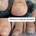 پدیکور و پودولوژیSD