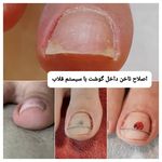 پدیکور و پودولوژیSD