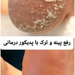 پدیکور و پودولوژیSD