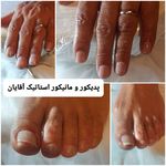 پدیکور و پودولوژیSD