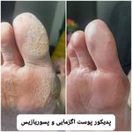 پدیکور و پودولوژیSD