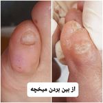 پدیکور و پودولوژیSD