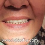 دندانسازی ظفر