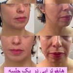 کلینیک پوست مو لیزر و لاغری عصر زیبایی