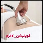 کلینیک پوست مو لیزر و لاغری عصر زیبایی