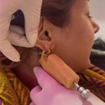 کلینیک پوست مو لیزر و لاغری عصر زیبایی