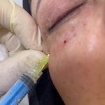 کلینیک پوست مو لیزر و لاغری عصر زیبایی