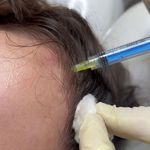 کلینیک پوست مو لیزر و لاغری عصر زیبایی